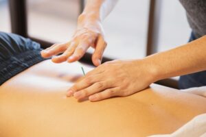 Acupuncturist London Bridge SE1